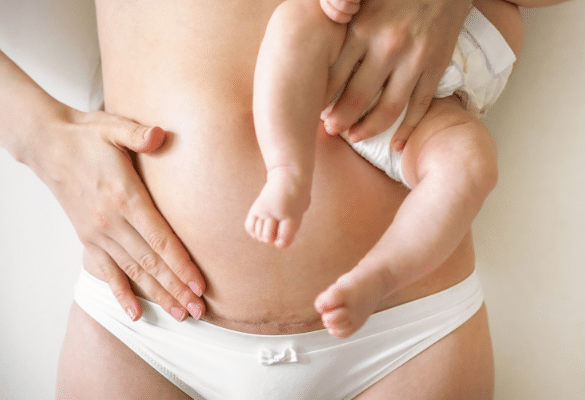 Les culottes de règles pour les suites de couches post accouchement